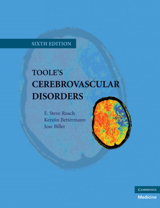 Toole's Cerebrovascular Disorders (e-bog) af Biller, Jose