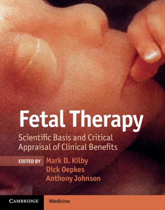 Fetal Therapy (e-bog) af -