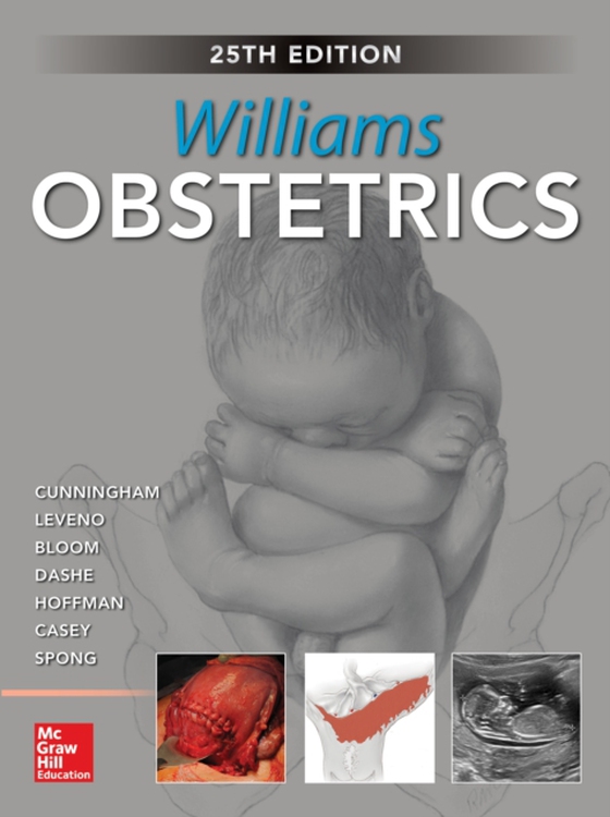 Williams Obstetrics, 25th Edition (e-bog) af Hoffman, Barbara L.