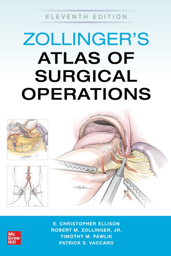 Zollinger's Atlas of Surgical Operations, Eleventh Edition (e-bog) af Vaccaro, Patrick