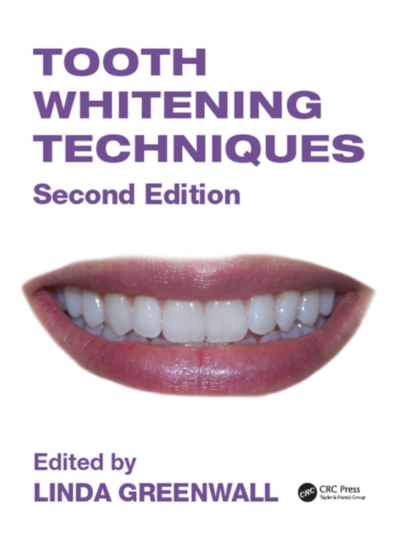 Tooth Whitening Techniques (e-bog) af -