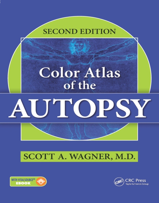 Color Atlas of the Autopsy