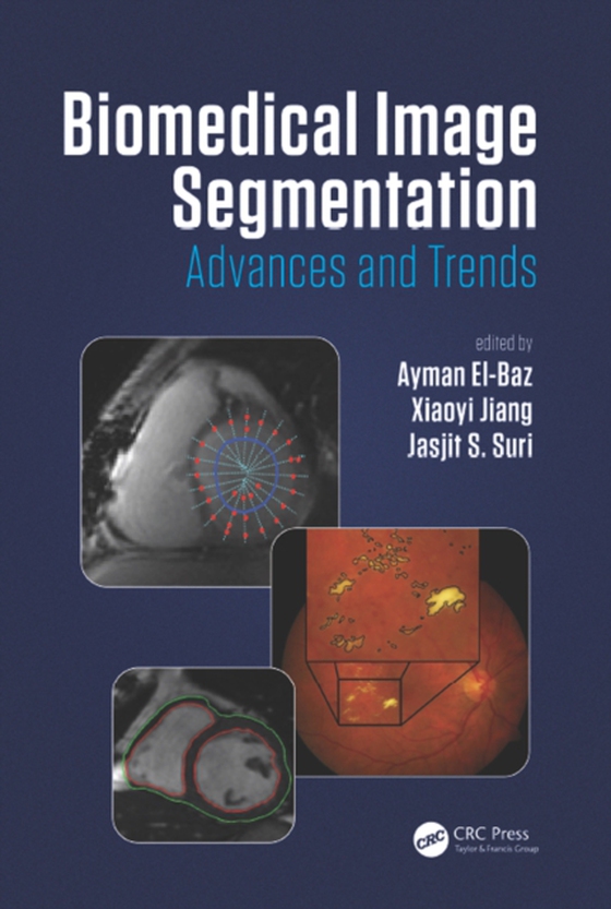 Biomedical Image Segmentation (e-bog) af -