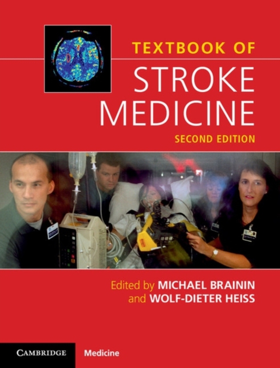 Textbook of Stroke Medicine