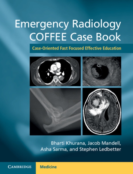 Emergency Radiology COFFEE Case Book (e-bog) af -