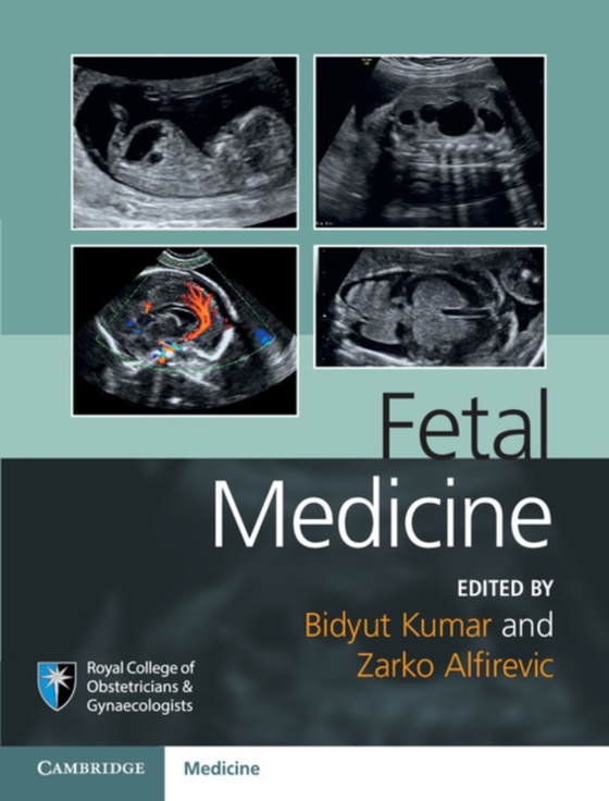 Fetal Medicine (e-bog) af -