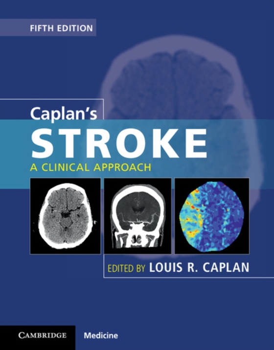 Caplan's Stroke (e-bog) af -