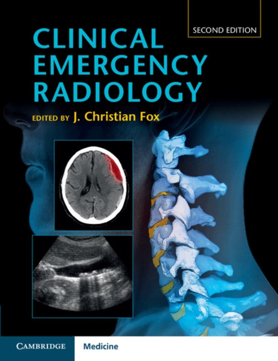 Clinical Emergency Radiology (e-bog) af -