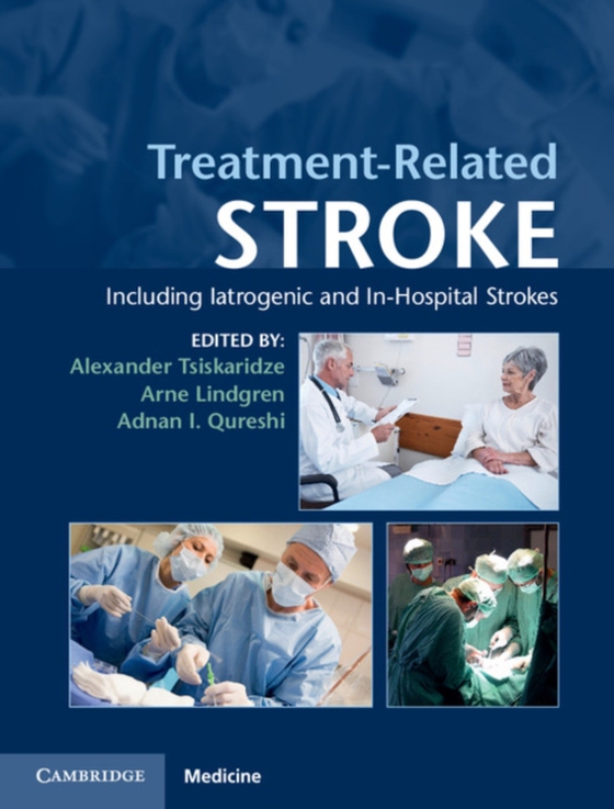 Treatment-Related Stroke (e-bog) af -