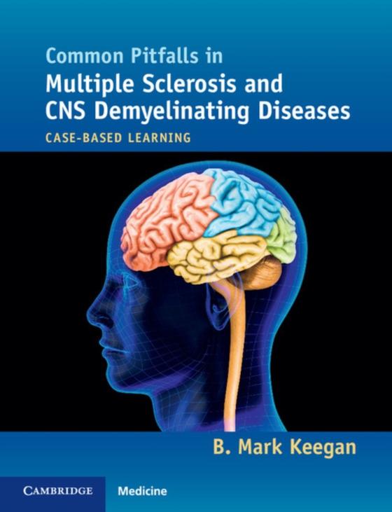 Common Pitfalls in Multiple Sclerosis and CNS Demyelinating Diseases (e-bog) af Keegan, B. Mark