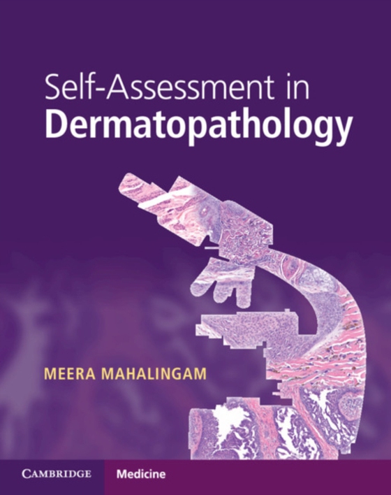 Self-Assessment in Dermatopathology (e-bog) af Mahalingam, Meera