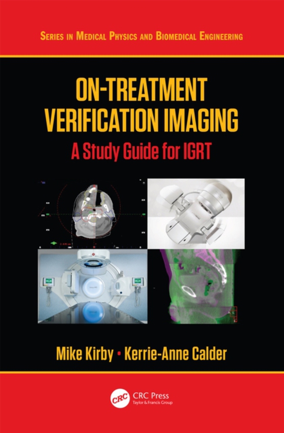 On-Treatment Verification Imaging (e-bog) af Calder, Kerrie-Anne