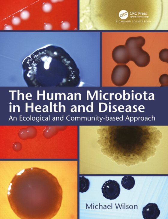 Human Microbiota in Health and Disease (e-bog) af Wilson, Mike