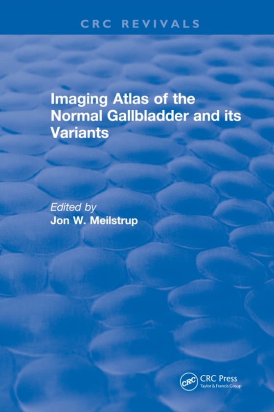 Imaging Atlas of the Normal Gallbladder and Its Variants (e-bog) af Meilstrup, J.W.