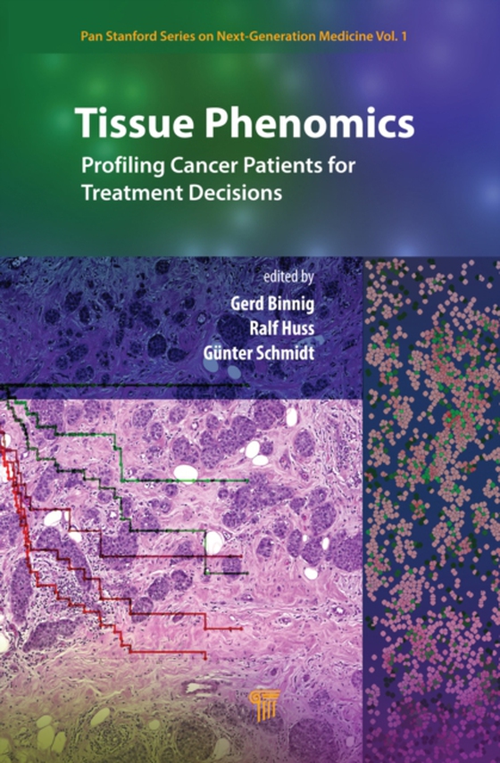 Tissue Phenomics: Profiling Cancer Patients for Treatment Decisions (e-bog) af Schmidt, Gunter