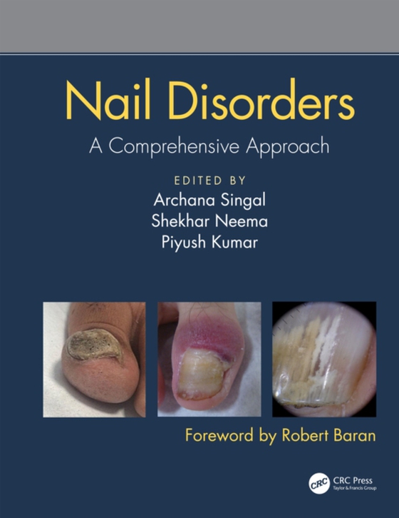 Nail Disorders (e-bog) af -