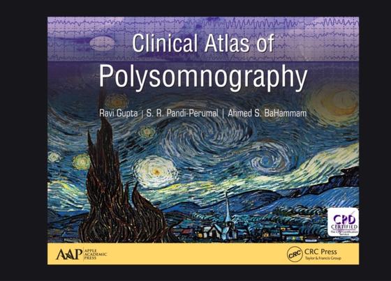 Clinical Atlas of Polysomnography (e-bog) af BaHammam, Ahmed S.