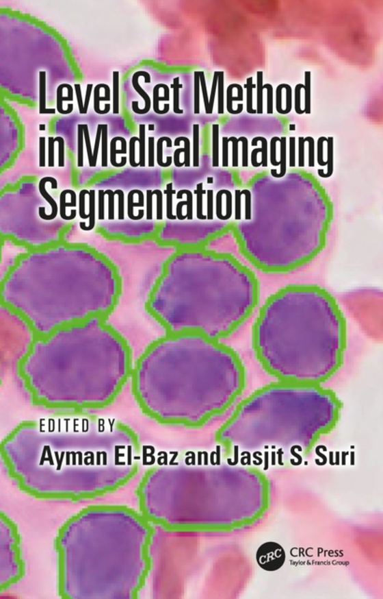 Level Set Method in Medical Imaging Segmentation (e-bog) af -