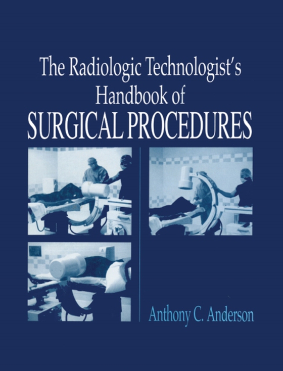 Radiology Technologist's Handbook to Surgical Procedures (e-bog) af Anderson, AnthonyC