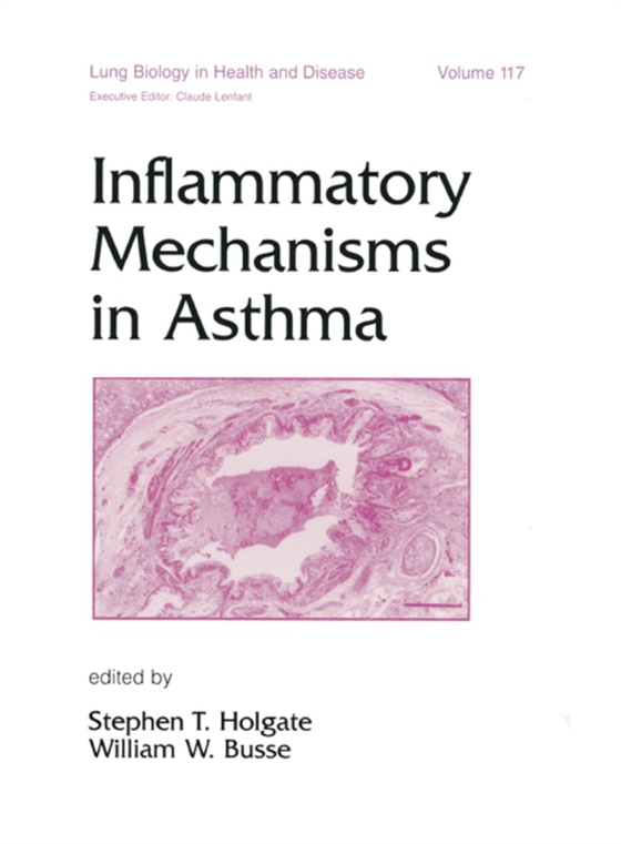 Inflammatory Mechanisms in Asthma (e-bog) af -