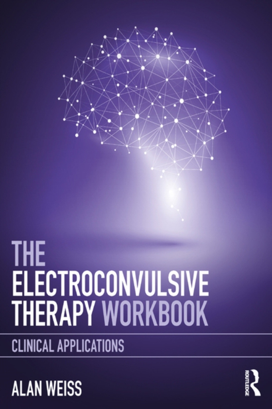 Electroconvulsive Therapy Workbook (e-bog) af Weiss, Alan