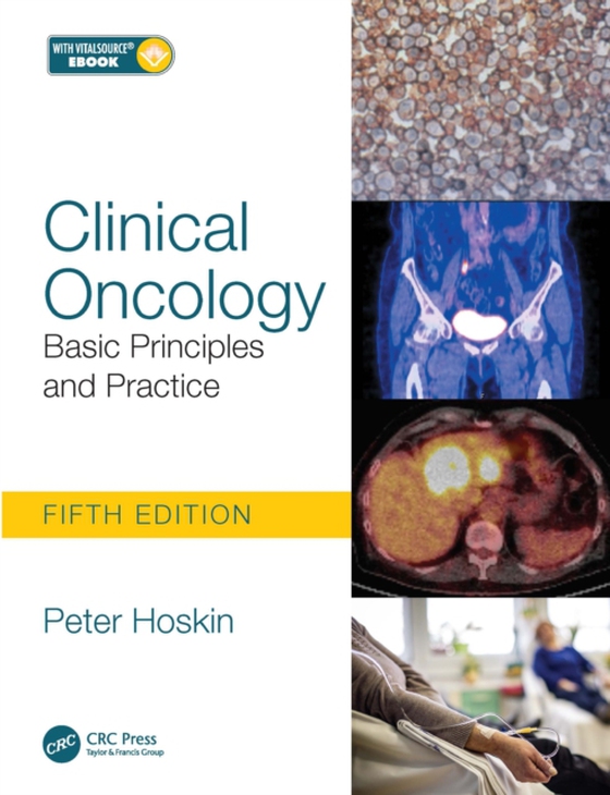 Clinical Oncology (e-bog) af Hoskin, Peter