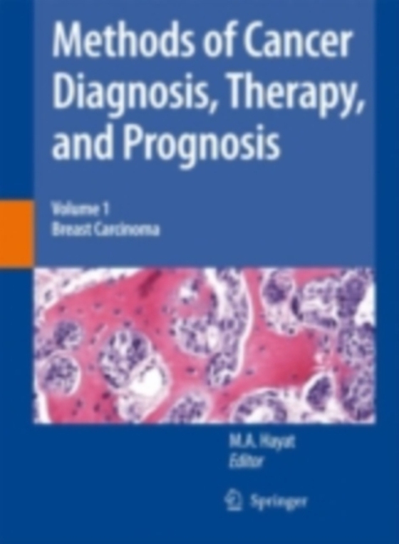 Methods of Cancer Diagnosis, Therapy and Prognosis