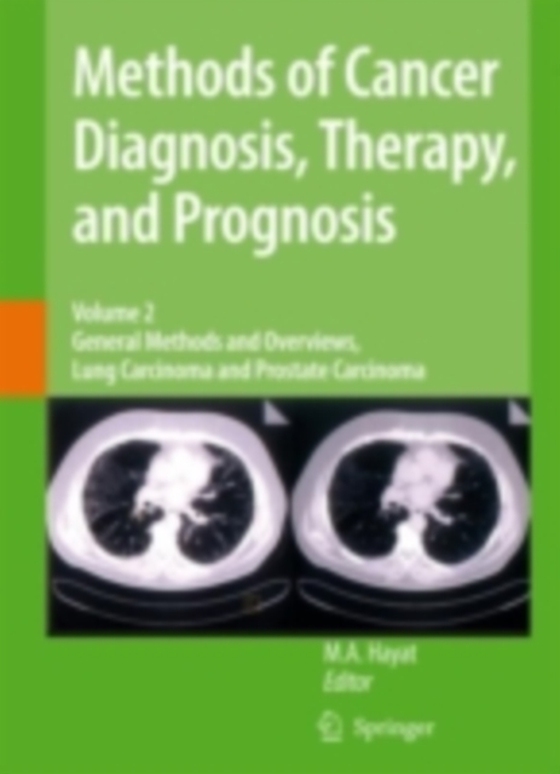 Methods of Cancer Diagnosis, Therapy and Prognosis (e-bog) af -