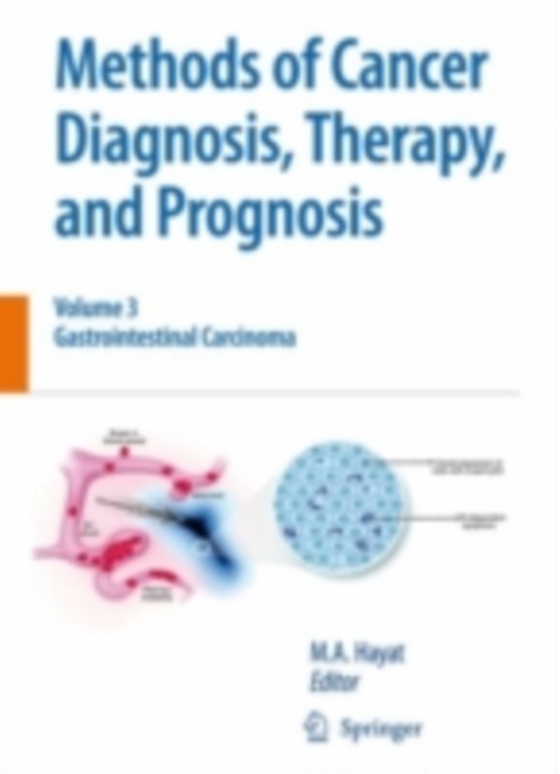 Methods of Cancer Diagnosis, Therapy and Prognosis (e-bog) af -