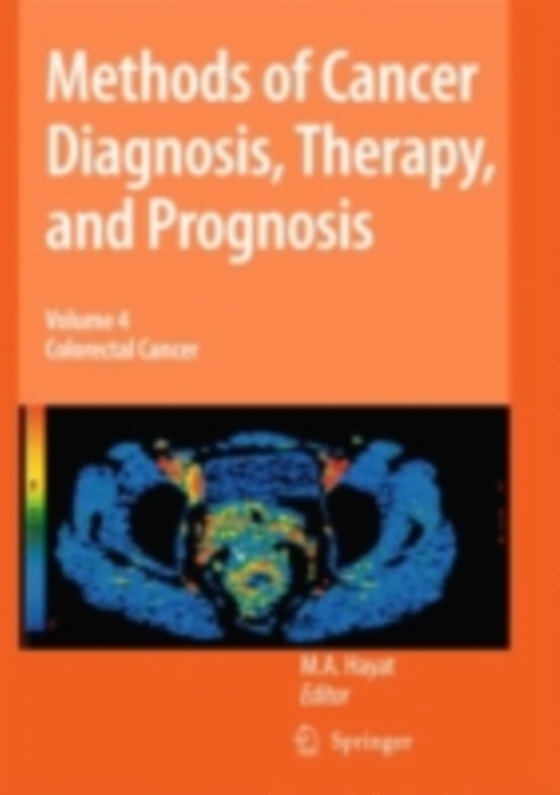 Methods of Cancer Diagnosis, Therapy and Prognosis (e-bog) af -