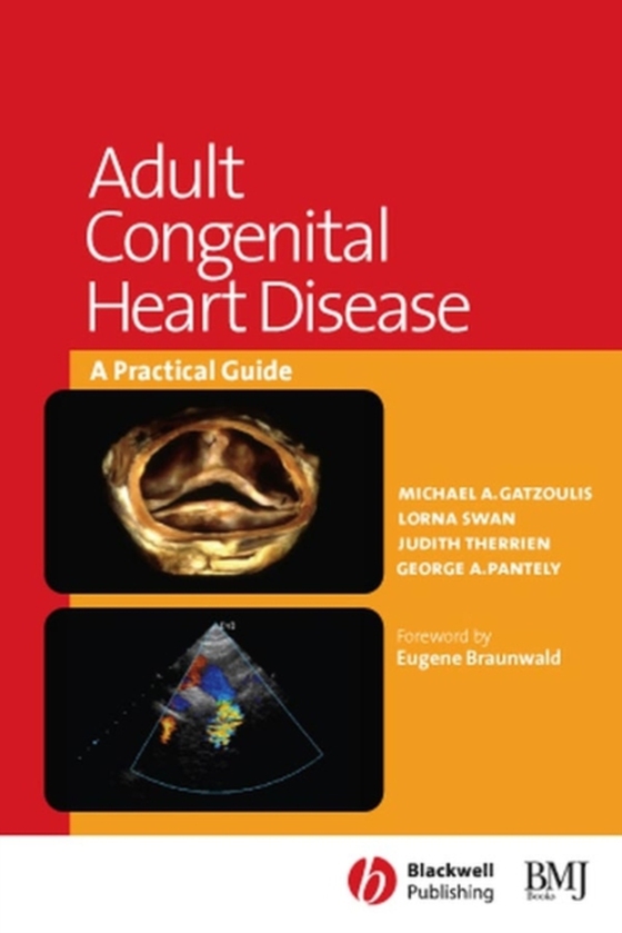 Adult Congenital Heart Disease (e-bog) af Pantely, George A.