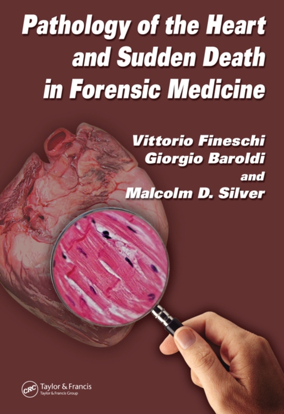 Pathology of the Heart and Sudden Death in Forensic Medicine (e-bog) af Silver, Malcolm D.