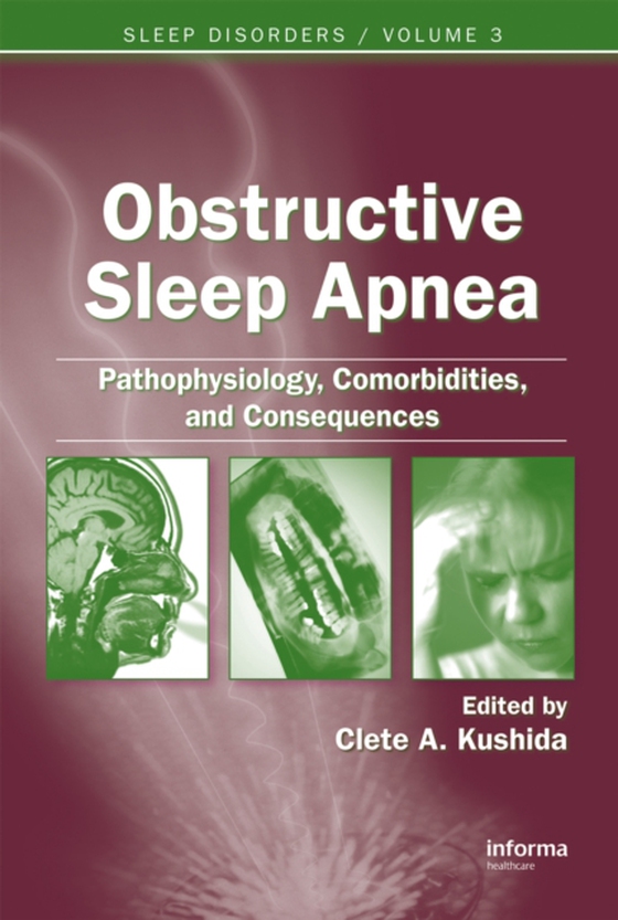 Obstructive Sleep Apnea: Pathophysiology, Comorbidities and Consequences (e-bog) af -