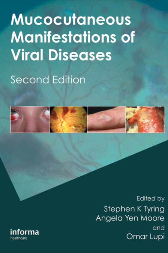 Mucocutaneous Manifestations of Viral Diseases (e-bog) af -