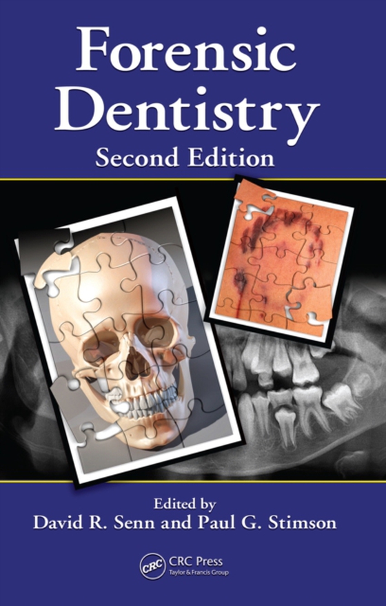 Forensic Dentistry (e-bog) af -