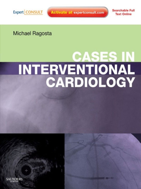 Cases in Interventional Cardiology E-book (e-bog) af Ragosta, Michael