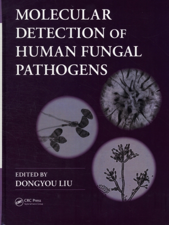 Molecular Detection of Human Fungal Pathogens (e-bog) af -