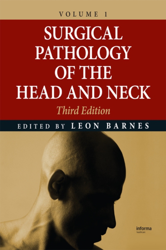 Surgical Pathology of the Head and Neck (e-bog) af Barnes, Leon