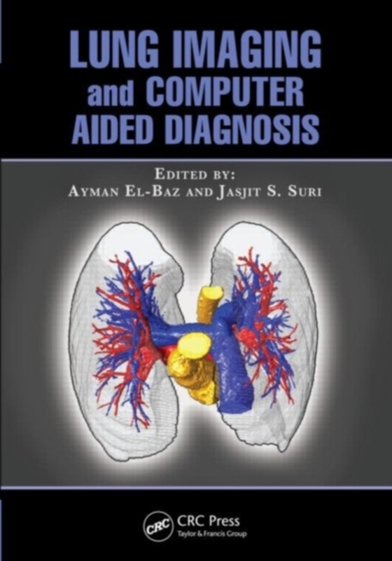 Lung Imaging and Computer Aided Diagnosis (e-bog) af -