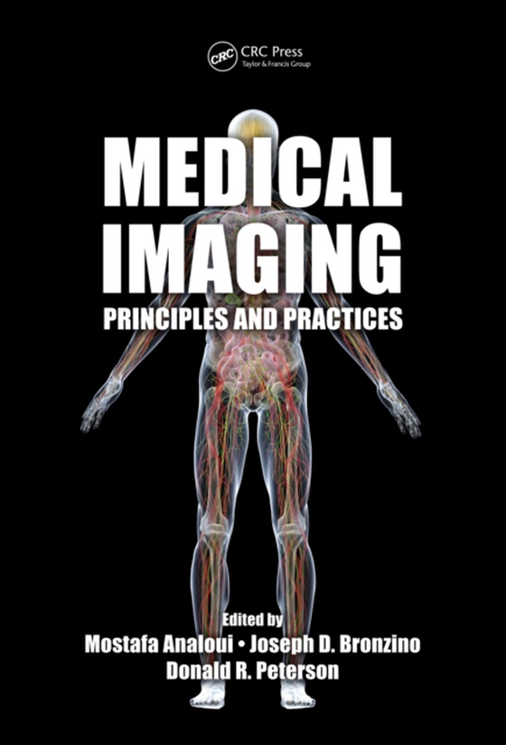 Medical Imaging (e-bog) af -