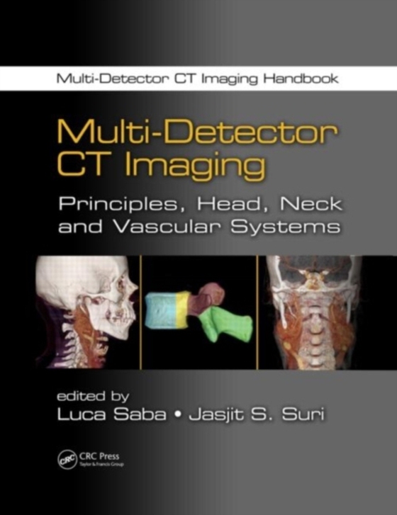 Multi-Detector CT Imaging (e-bog) af -