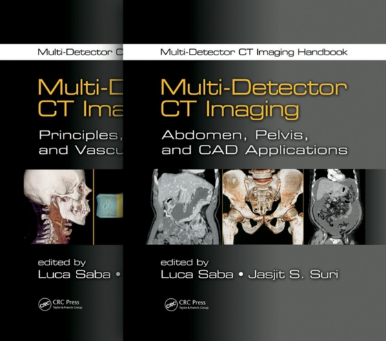 Multi-Detector CT Imaging Handbook, Two Volume Set