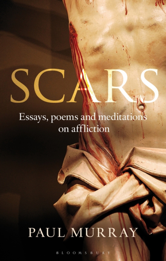 Scars (e-bog) af Paul Murray OP, Murray OP