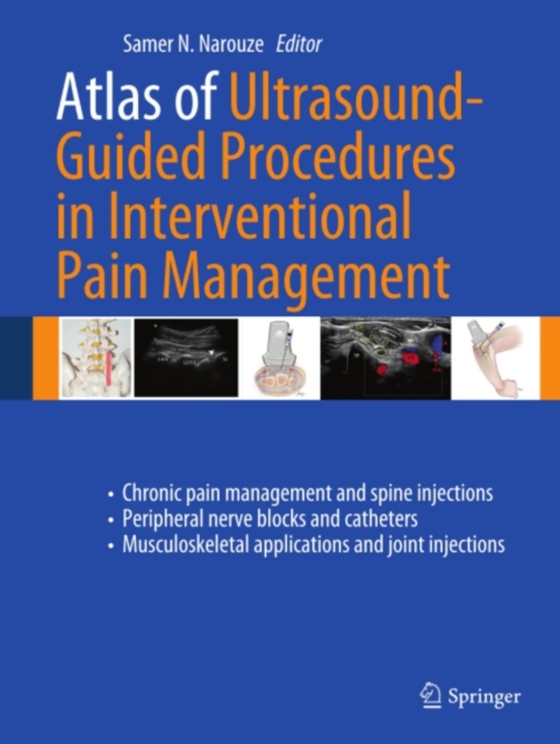 Atlas of Ultrasound-Guided Procedures in Interventional Pain Management (e-bog) af -