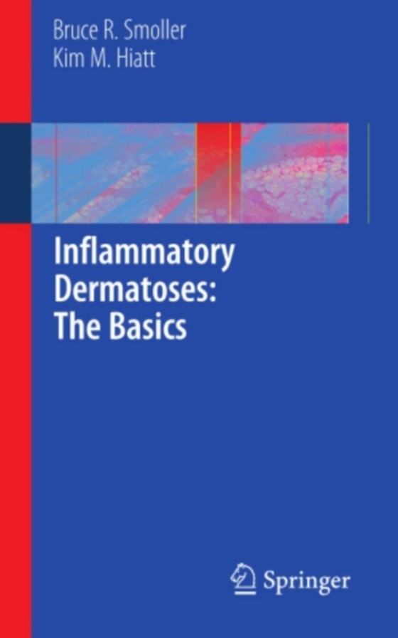 Inflammatory Dermatoses: The Basics (e-bog) af Hiatt, Kim M.