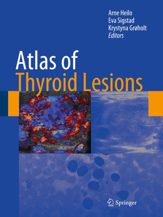 Atlas of Thyroid Lesions (e-bog) af -