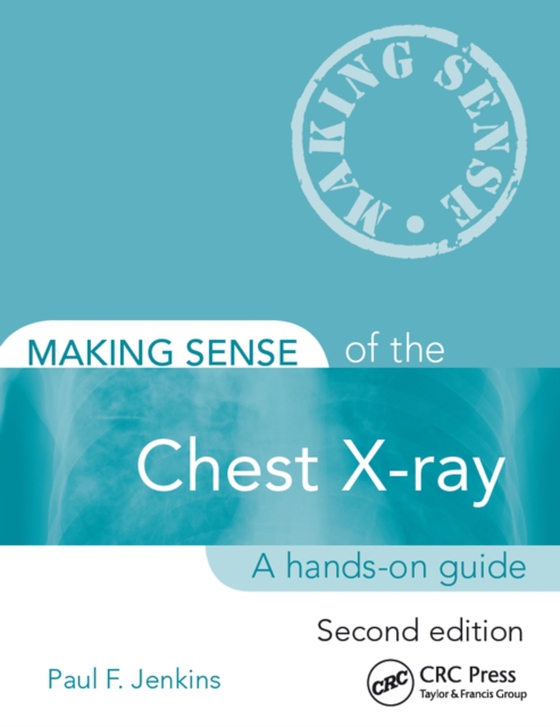 Making Sense of the Chest X-ray (e-bog) af Jenkins, Paul