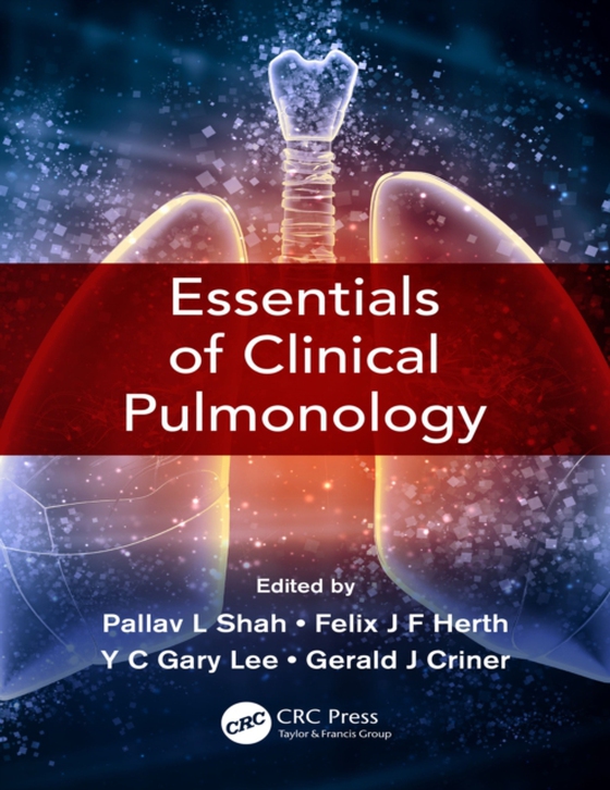 Essentials of Clinical Pulmonology (e-bog) af Criner, Gerard J