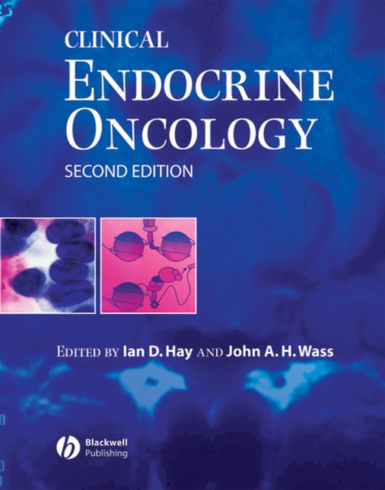 Clinical Endocrine Oncology (e-bog) af -