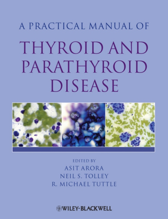 Practical Manual of Thyroid and Parathyroid Disease (e-bog) af -